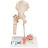 Model zlomeniny ľudskej stehennej kosti a osteoartrózy bedrového kĺbu (Anatomické modely)