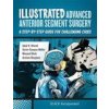 Illustrated Advanced Anterior Segment Surgery (I. Ahmed)(Pevná)