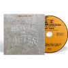 Neil Young, YOUNG, NEIL - BEFORE AND AFTER - 1BRD, Blu-ray
