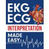 EKG ECG Interpretation Made Easy (Nedu)(Brožovaná)