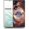 Picasee silikónový prehľadný obal pre Honor 70 - Nebula