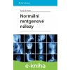 E-kniha Normální rentgenové nálezy - Möller Torsten B.