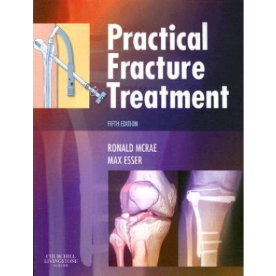 Practical Fracture Treatment - R. McRae, M. Esser