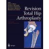 Revision Total Hip Arthroplasty (Benjamin E. Bierbaum,James V. Bono,Joseph C. McCarthy,Thomas S. Thornhill,Roderick H. Turner)(Brožovaná)