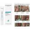 Podopharm Onygen Krém na nechty 20 ml