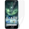 Ochranná fólia Screenshield NOKIA 7.2 (2019) - displej