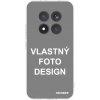 Picasee silikónový prehľadný obal pre Xiaomi Redmi Note 15 Pro+ - Vlastný design/motiv