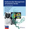 Endovascular Management of Ischemic Stroke (Lee-Ann Slater,Sarah Power,Timo Krings)(Brožovaná)
