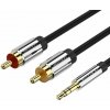 Vention 3.5 mm Jack Male to 2× RCA Male Audio Cable 0.5 m Black Metal Type BCFBD