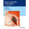 Reverse Shoulder Arthroplasty