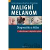 Maligní melanom - Diagnostika a léčba - Petr Arenberger