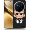 Picasee silikónový čierny obal pre Vivo X200 Pro - Separ