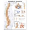 Human Spine Disorders Anatomical Chart (Anatomical Chart Company)(Brožovaná)