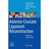 Anterior Cruciate Ligament Reconstruction (Rainer Siebold,David Dejour,Stefano Zaffagnini)(Pevná)