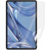 Screenshield DOOGEE T20 LTE fólie na displej DOO-T20-D