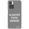 Púzdro Picasee silikónové Xiaomi Redmi Note 11 Pro+ 5G - Vlastný design/motiv čiré