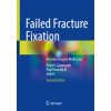 Failed Fracture Fixation (Peter V. Giannoudis,Paul Tornetta III)(Pevná)