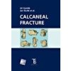Calcaneal fracture - Jiří Stehlík Jan Štulík