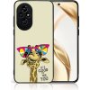 VSETKONAMOBIL 88052 MY ART Ochranný kryt pre Honor 200 GIRAFFE (180)
