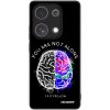 Picasee ULTIMATE CASE pro Xiaomi Redmi Note 13 Pro 4G - Brain - White