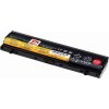 Batéria do notebooku T6 Power Lenovo ThinkPad L560, L570, 5200mAh, 56Wh, 6cell (NBIB0183)