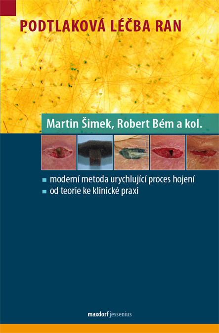 Podtlaková léčba ran - Martin Šimek Robert Bém