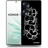 Picasee silikónový čierny obal pre Honor 70 - Throw UP