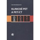 Klinické PET a PET/CT - Jana Votrubová