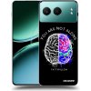 Picasee silikónový čierny obal pre OnePlus Nord 4 - Brain - White