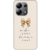Picasee Fashion Case pre Xiaomi Redmi Note 13 4G - Golden Dream
