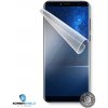 Screenshield CUBOT X18 fólie na displej CUB-X18-D
