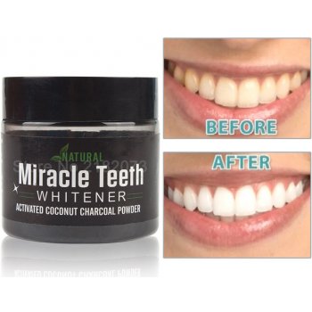 Miracle Teeth na bělení zubů 20g