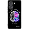 Picasee ULTIMATE CASE pro Xiaomi Poco X7 Pro 5G - Brain - White