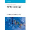 Kardioonkologie Beata Mladosievičová 2014 (E-kniha)