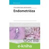 E-kniha Endometrióza - Jiří Lenz, Radek Chvátal, Luděk Fiala