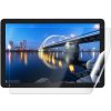 Screenshield IGET Smart L31 FullHD fólie na displej IGT-SML31FHD-D