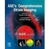 ASE's Comprehensive Strain Imaging