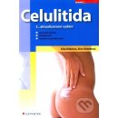 Celulitida