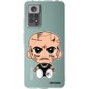 Picasee silikónový prehľadný obal pre Xiaomi Redmi Note 11 - Separ