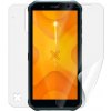 Screenshield MYPHONE Hammer Energy X fólia na celé telo MYP-HENRGX-B