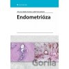 Endometrióza - Jiří Lenz, Radek Chvátal, Luděk Fiala
