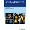 SPECT and SPECT/CT