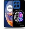 Picasee silikónový čierny obal pre Motorola Edge 50 Neo - Brain - White