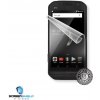 Screenshield DOOGEE S30 fólia na displej DOO-S30-D