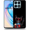 Picasee ULTIMATE CASE pro Honor X8a - Francúzsky Buldoček