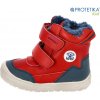 Protetika - zimné topánky TORIN red - zateplené kožušinkou - TOP AKCIA! Veľkosť: 20