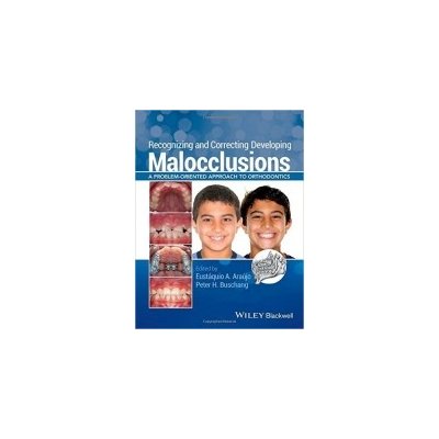 Recognizing and Correcting Developing Malocclusions - Araujo, E. A.