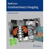 Radcases Genitourinary Imaging (Shailendra Chopra)(Brožovaná)