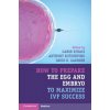 How to Prepare the Egg and Embryo to Maximize IVF Success (Gabor Kovacs,Anthony Rutherford,David K. Gardner)(Brožovaná)
