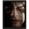 Pyramid International 3D obraz Harry Potter Harry vs. Voldemort